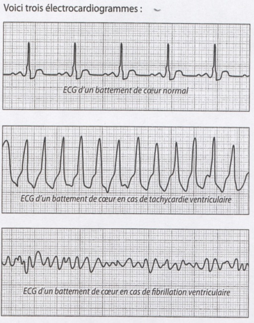 Schéma du circuit électrique du coeur
